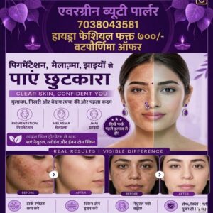 Pigmentation, Melasma & Freckle Treatment